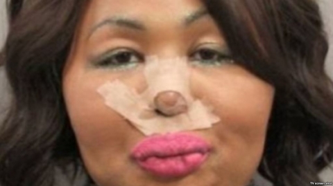 تسرق البنوك لتنفق على عمليات التجميل